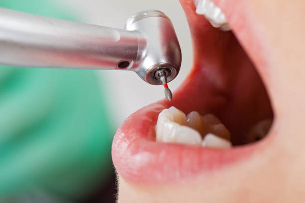 Best Dentist for Tooth Abscess  in Syosset, NY